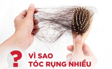 Nguyên nhân phổ biến gây rụng tóc do đâu, khắc phục như thế nào?
