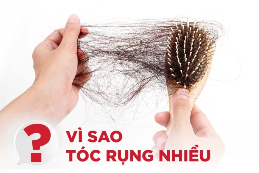 Nguyên nhân phổ biến gây rụng tóc do đâu, khắc phục như thế nào?